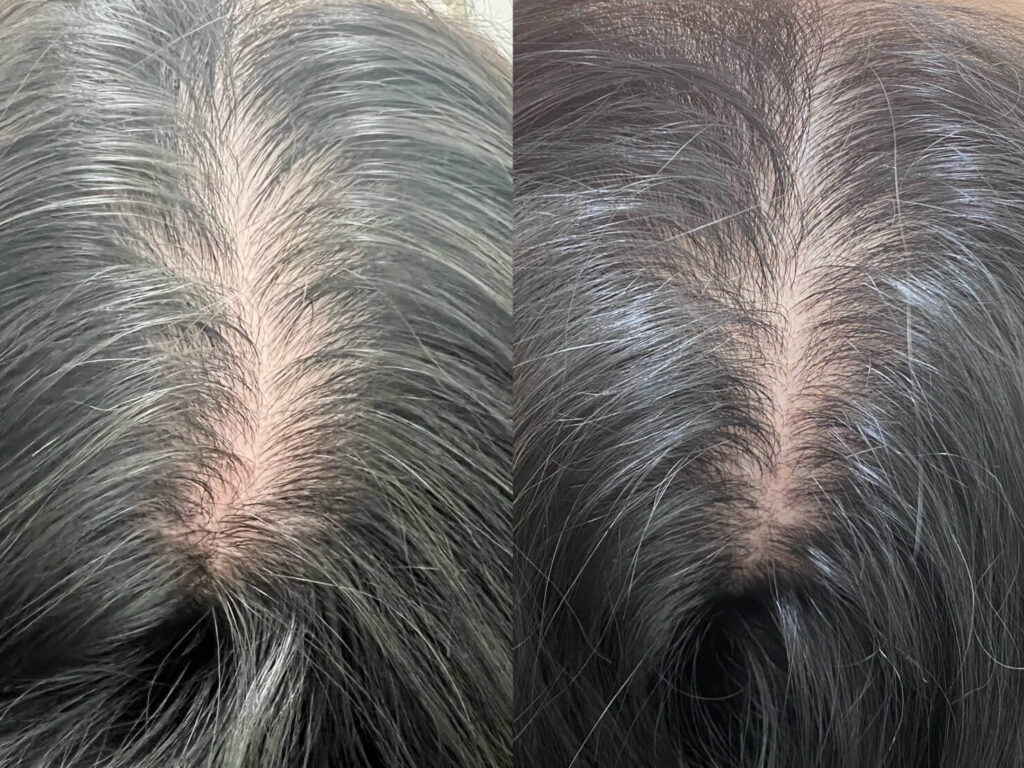 スーパースカルプ