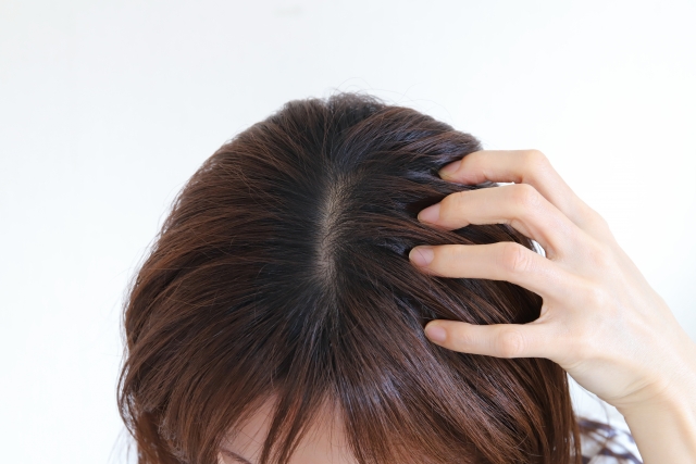 食べ物だけでの薄毛を治すことは可能?