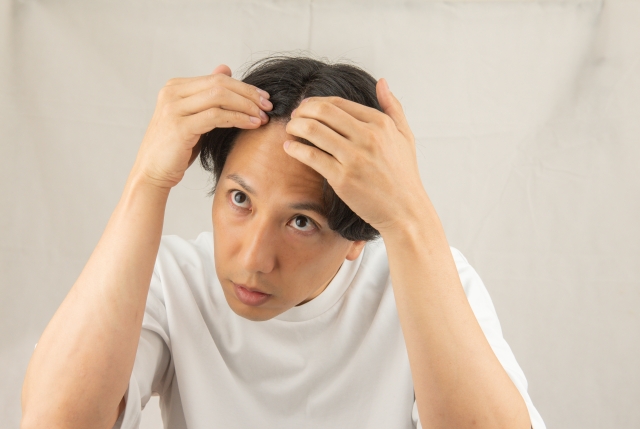 あなたの髪は大丈夫?将来薄毛になりやすい人の特徴とは?