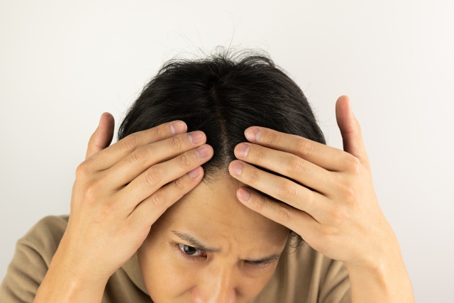 10代で若ハゲ?気になる症状とは?
