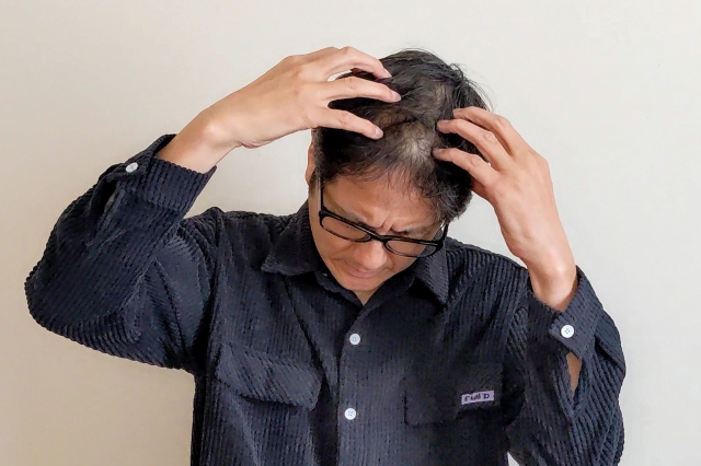 AGA治療の効果が現れにくい状態のケースとは?