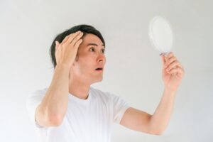 AGAによる生え際の後退は治る？見分け方・原因・効果的な治療法を徹底解説