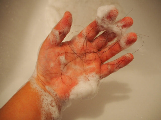 ミノキをいきなり辞めてしまうと、抜け毛が多く発生する