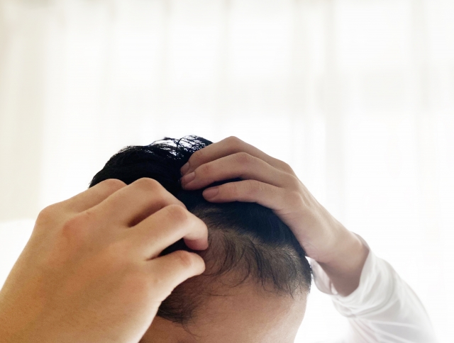 あなたの抜け毛は、危険な抜け毛？切れ毛？セルフチェック