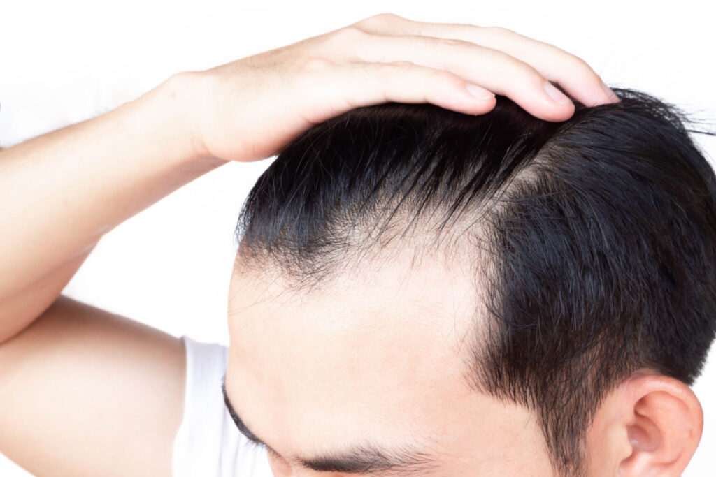 フィナステリドで性欲は減退する？副作用の確率と対処法を徹底解説