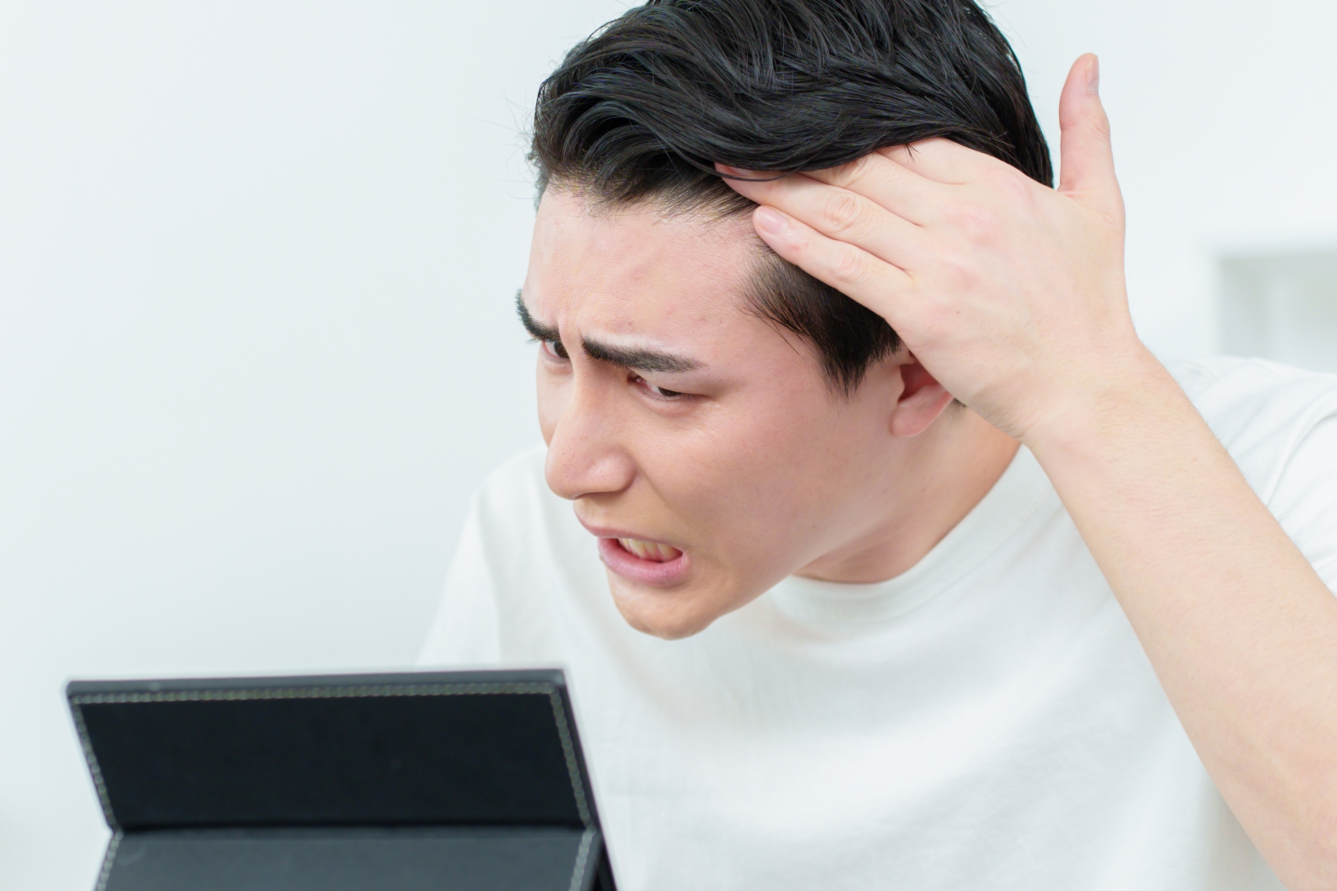 生え際を気にしすぎ？薄毛かどうか不安な時の見分け方