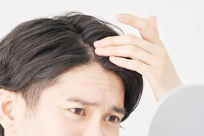 生え際が気になるのは「気にしすぎ」とは限らない