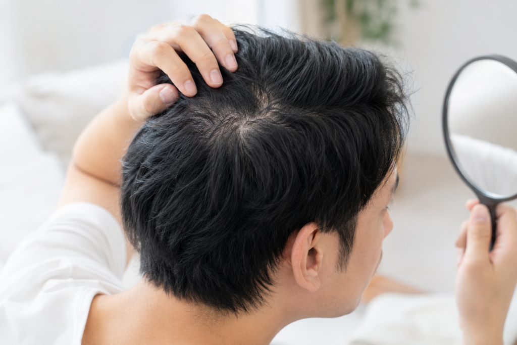 年代別に見る薄毛・AGAの傾向